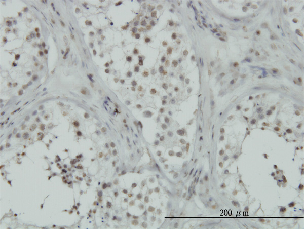 Immunoperoxidase of monoclonal antibody to C15orf15 on formalin-fixed paraffin-embedded human testis. [antibody concentration 1 ug/ml]