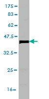 Antibody Reactive Against Recombinant Protein.Western Blot detection against Immunogen (36.63 KDa) . 