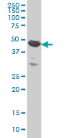 BTBD1 monoclonal antibody (M01), clone 3E11 Western Blot analysis of BTBD1 expression in HeLa ( (Cat # AT1315a )