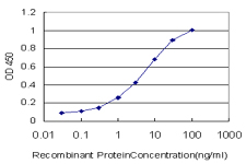 Detection limit for recombinant GST tagged BCL7C is approximately 0.1ng/ml as a capture antibody.