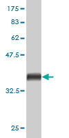 Antibody Reactive Against Recombinant Protein.Western Blot detection against Immunogen (37.51 KDa) . 