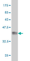 Antibody Reactive Against Recombinant Protein.Western Blot detection against Immunogen (36.52 KDa) . 
