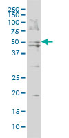 BAAT monoclonal antibody (M02), clone 5B6 Western Blot analysis of BAAT expression in HepG2 ( (Cat # AT1257a )