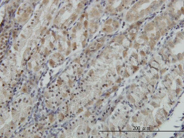 Immunoperoxidase of monoclonal antibody to ATP6V0D1 on formalin-fixed paraffin-embedded human stomach. [antibody concentration 0.5 ug/ml]