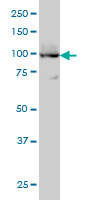 ATP2A3 monoclonal antibody (M01), clone 2H3 Western Blot analysis of ATP2A3 expression in HL-60 ( (Cat # AT1234a )