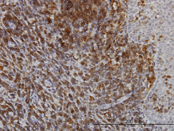 Immunoperoxidase of monoclonal antibody to ATP2A3 on formalin-fixed paraffin-embedded human tonsil. [antibody concentration 3 ug/ml]