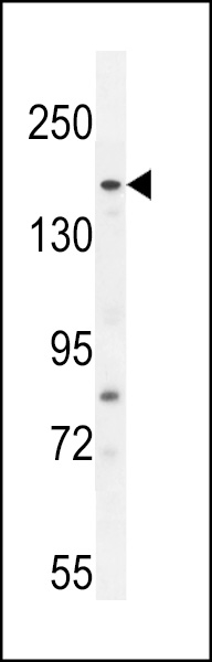 FGD6 Antibody (C-term) (Cat. #AP11108b) western blot analysis in A549 cell line lysates (35ug/lane).This demonstrates the FGD6 antibody detected the FGD6 protein (arrow).