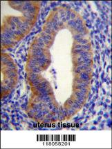 FGD6 Antibody (C-term) (Cat. #AP11108b)immunohistochemistry analysis in formalin fixed and paraffin embedded human uterus tissue followed by peroxidase conjugation of the secondary antibody and DAB staining.This data demonstrates the use of FGD6 Antibody (C-term) for immunohistochemistry. Clinical relevance has not been evaluated.