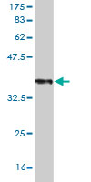 Antibody Reactive Against Recombinant Protein.Western Blot detection against Immunogen (37.73 KDa) . 