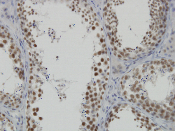 Immunoperoxidase of monoclonal antibody to DDX26 on formalin-fixed paraffin-embedded human testis. [antibody concentration 3 ug/ml]