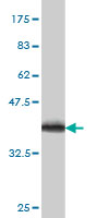 Antibody Reactive Against Recombinant Protein.Western Blot detection against Immunogen (36.74 KDa) . 