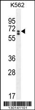 CLIP3 Antibody (C-term) (Cat. #AP11084b) western blot analysis in K562 cell line lysates (35ug/lane).This demonstrates the CLIP3 antibody detected the CLIP3 protein (arrow).