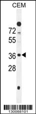 C10orf78 Antibody (N-term) (Cat. #AP11080a) western blot analysis in CEM cell line lysates (35ug/lane).This demonstrates the C10orf78 antibody detected the C10orf78 protein (arrow).