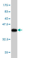 Antibody Reactive Against Recombinant Protein.Western Blot detection against Immunogen (36.74 KDa) . 