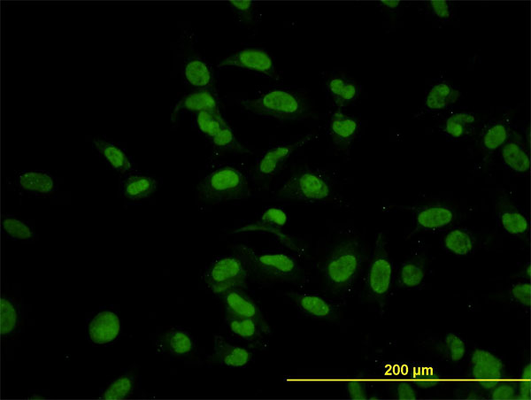 Immunofluorescence of monoclonal antibody to CMAS on HeLa cell. [antibody concentration 10 ug/ml]