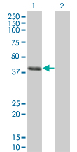 Western Blot analysis of CLN3 expression in transfected 293T cell line by CLN3 monoclonal antibody (M03), clone 1G10.Lane 1: CLN3 transfected lysate(47.623 KDa).Lane 2: Non-transfected lysate.
