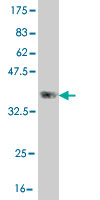 Antibody Reactive Against Recombinant Protein.Western Blot detection against Immunogen (36.85 KDa) .