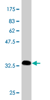 Antibody Reactive Against Recombinant Protein.Western Blot detection against Immunogen (34.43 KDa) . 