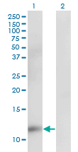 Western Blot analysis of CKS2 expression in transfected 293T cell line by CKS2 monoclonal antibody (M02), clone 2G12-2A5.Lane 1: CKS2 transfected lysate(9.9 KDa).Lane 2: Non-transfected lysate.