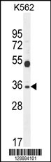 SULT1C3 Antibody (C-term) (Cat. #AP11072b) western blot analysis in K562 cell line lysates (35ug/lane).This demonstrates the SULT1C3 antibody detected the SULT1C3 protein (arrow).