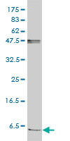 FXYD2 monoclonal antibody (M01), clone 1C3-B3 Western Blot analysis of FXYD2 expression in Jurkat ( (Cat # AT2128a )