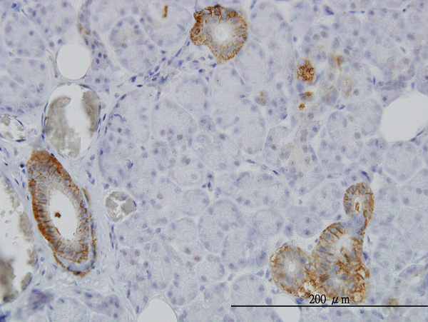 Immunoperoxidase of monoclonal antibody to FXYD2 on formalin-fixed paraffin-embedded human salivary gland. [antibody concentration 3 ug/ml]