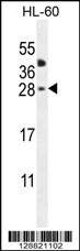 CLEC2A Antibody (Center) (Cat. #AP11060c) western blot analysis in HL-60 cell line lysates (35ug/lane).This demonstrates the CLEC2A antibody detected the CLEC2A protein (arrow).