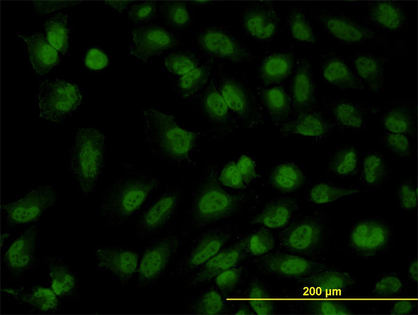 Immunofluorescence of monoclonal antibody to FOXR2 on HeLa cell. [antibody concentration 10 ug/ml]