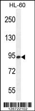 ENASE Antibody (Center) (Cat. #AP11055c) western blot analysis in HL-60 cell line lysates (35ug/lane).This demonstrates the ENASE antibody detected the ENASE protein (arrow).