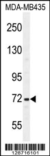SRBD1 Antibody (C-term) (Cat. #AP11054b) western blot analysis in MDA-MB435 cell line lysates (35ug/lane).This demonstrates the SRBD1 antibody detected the SRBD1 protein (arrow).