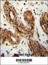 CI150 Antibody (N-term) (Cat. #AP11051a) immunohistochemistry analysis in formalin fixed and paraffin embedded human breast tissue followed by peroxidase conjugation of the secondary antibody and DAB staining. This data demonstrates the use of the CI150 Antibody (N-term) for immunohistochemistry. Clinical relevance has not been evaluated.