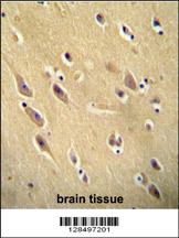CYB561D1 antibody (C-term) (Cat. #AP11046b) immunohistochemistry analysis in formalin fixed and paraffin embedded human brain tissue followed by peroxidase conjugation of the secondary antibody and DAB staining. This data demonstrates the use of the CYB561D1 antibody (C-term) for immunohistochemistry. Clinical relevance has not been evaluated.