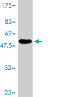 Antibody Reactive Against Recombinant Protein.Western Blot detection against Immunogen (56.98 KDa) . 