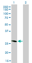 Western Blot analysis of FHL5 expression in transfected 293T cell line by FHL5 monoclonal antibody (M01), clone 1G12-D2.Lane 1: FHL5 transfected lysate(32.8 KDa).Lane 2: Non-transfected lysate.