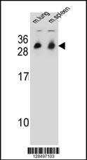 CYB561D1 Antibody (C-term) (Cat. #AP11046b) western blot analysis in mouse lung,spleen tissue lysates (35ug/lane).This demonstrates the CYB561D1 antibody detected the CYB561D1 protein (arrow).