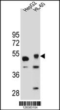 TIGD3 Antibody (C-term) (Cat. #AP11042b) western blot analysis in HepG2 and HL-60 cell line lysates (35ug/lane).This demonstrates the TIGD3 antibody detected the TIGD3 protein (arrow).