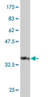 Antibody Reactive Against Recombinant Protein.Western Blot detection against Immunogen (36.74 KDa) . 