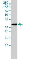 NSE1 monoclonal antibody (M01), clone 1C2 Western Blot analysis of NSE1 expression in HL-60 ( (Cat # AT1995a )
