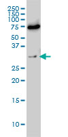EXOSC8 monoclonal antibody (M01), clone 1G5 Western Blot analysis of EXOSC8 expression in Hela S3 NE ( (Cat # AT1969a )