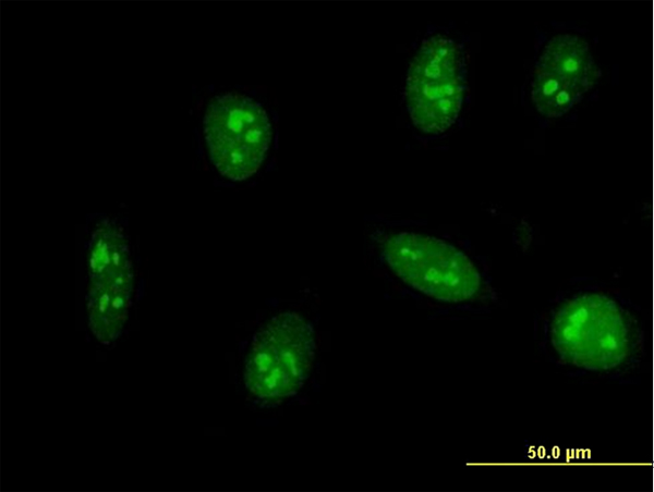 Immunofluorescence of monoclonal antibody to EXOSC5 on HeLa cell . [antibody concentration 10 ug/ml]
