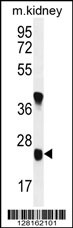 U119B Antibody (C-term) (Cat. #AP11026b) western blot analysis in mouse kidney tissue lysates (35ug/lane).This demonstrates the U119B antibody detected the U119B protein (arrow).
