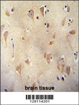 LRC40 antibody (C-term) (Cat. #AP11024b) immunohistochemistry analysis in formalin fixed and paraffin embedded human brain tissue followed by peroxidase conjugation of the secondary antibody and DAB staining. This data demonstrates the use of the LRC40 antibody (C-term) for immunohistochemistry. Clinical relevance has not been evaluated.