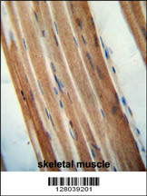 TMCO7 antibody (C-term) (Cat. #AP11022b) immunohistochemistry analysis in formalin fixed and paraffin embedded human skeletal muscle followed by peroxidase conjugation of the secondary antibody and DAB staining. This data demonstrates the use of the TMCO7 antibody (C-term) for immunohistochemistry. Clinical relevance has not been evaluated.