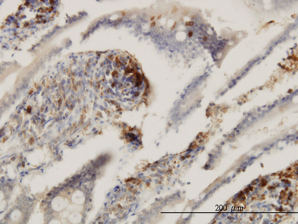 Immunoperoxidase of monoclonal antibody to ENTPD6 on formalin-fixed paraffin-embedded human small Intestine. [antibody concentration 3 ug/ml]