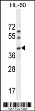 C17orf59 Antibody (Center) (Cat. #AP11018c) western blot analysis in HL-60 cell line lysates (35ug/lane).This demonstrates the C17orf59 antibody detected the C17orf59 protein (arrow).