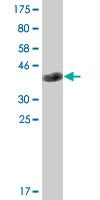 Antibody Reactive Against Recombinant Protein.Western Blot detection against Immunogen (36.63 KDa) . 