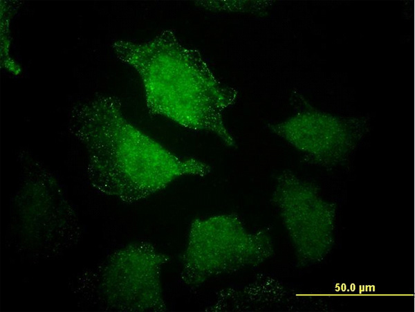 Immunofluorescence of monoclonal antibody to EHD3 on HeLa cell. [antibody concentration 25 ug/ml]