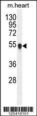 PPM1L Antibody (C-term) (Cat. #AP11001b) western blot analysis in mouse heart tissue lysates (35ug/lane).This demonstrates the PPM1L antibody detected the PPM1L protein (arrow).