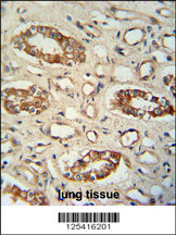 PPM1L antibody (C-term) (Cat. #AP11001b) immunohistochemistry analysis in formalin fixed and paraffin embedded human lung tissue followed by peroxidase conjugation of the secondary antibody and DAB staining. This data demonstrates the use of the PPM1L antibody (C-term) for immunohistochemistry. Clinical relevance has not been evaluated.