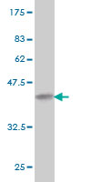 Antibody Reactive Against Recombinant Protein.Western Blot detection against Immunogen (36.74 KDa) . 